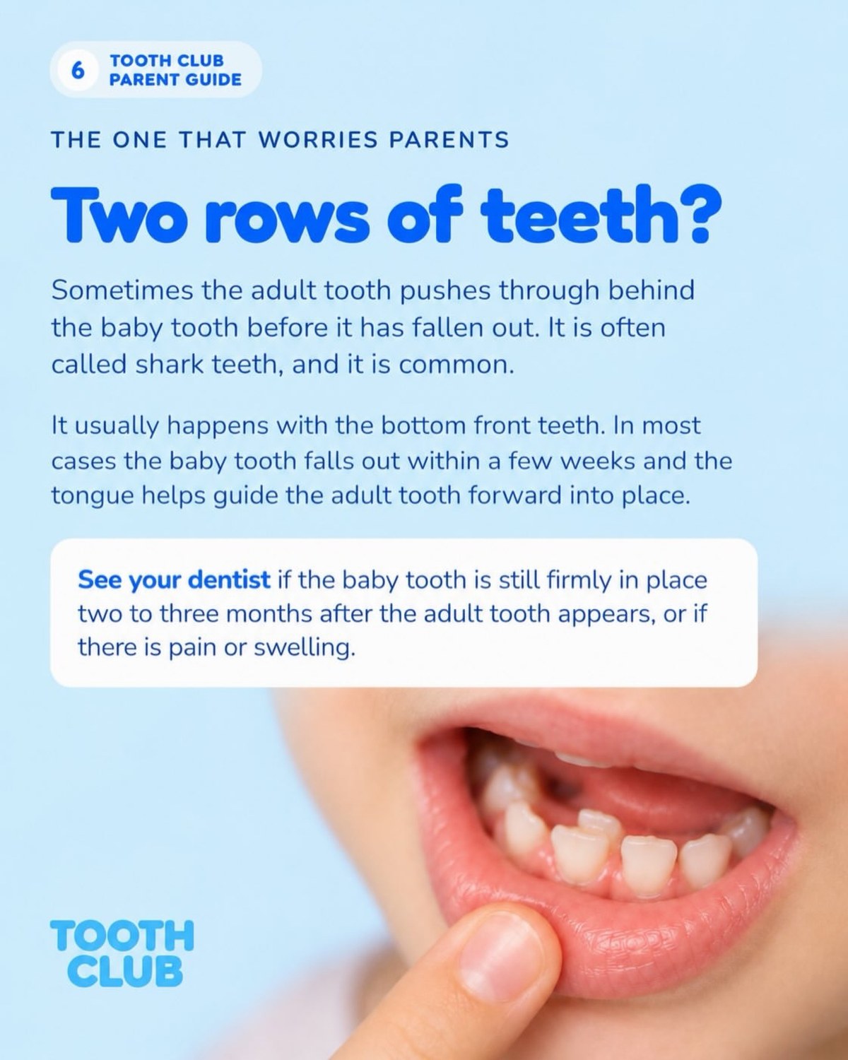 Slide 6: Two rows of teeth?