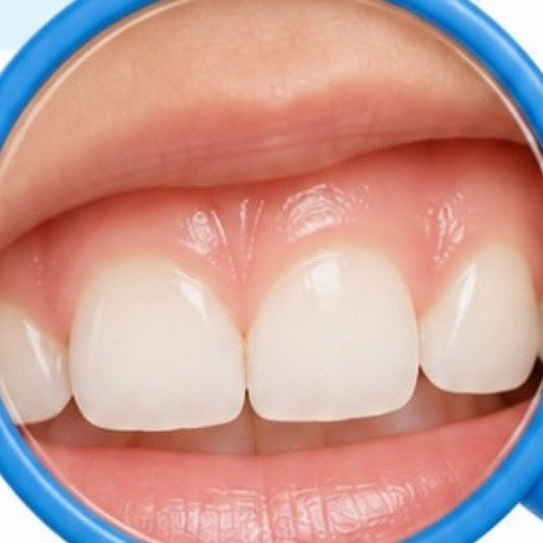 Close-up of healthy front teeth with pale pink gums